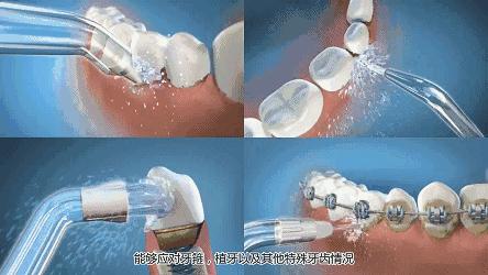 种植牙能降价多少钱啊,牙齿种植牙价格一览表