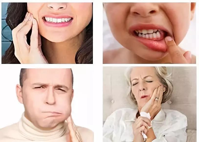 三十秒止痛口腔溃疡,5秒钟治口腔溃疡的药