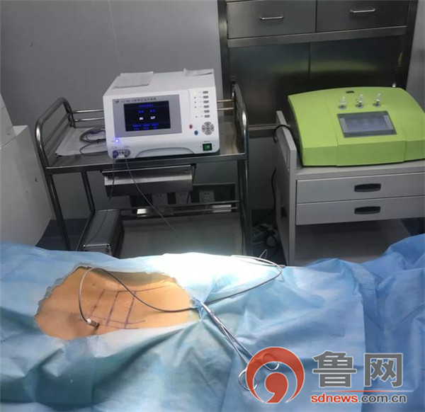 射频靶点热凝术治疗腰椎间盘突出,硬膜外腔注射治疗腰椎间盘突出症