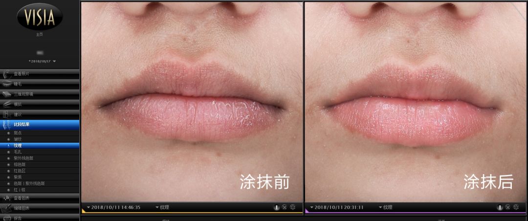 唇干用什么唇膏最安全,干唇救星唇膏