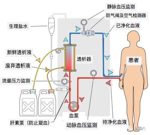 血浆置换和血透区别,血浆置换和血透的区别是什么