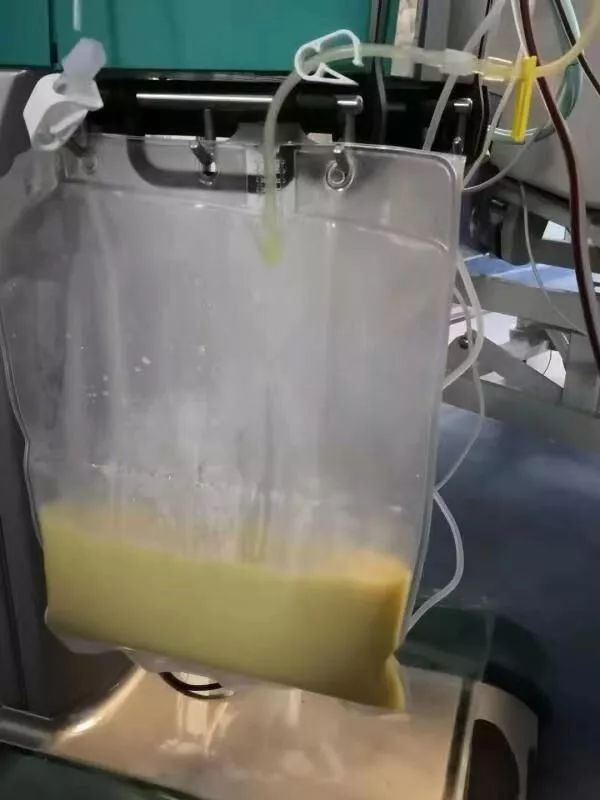 17岁少女抽出粉红色的血,瞬间凝固差点丢命!原因竟是3年前开始……