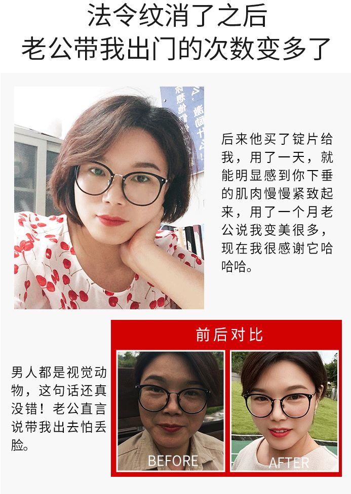 你的法令纹怎么去,你的法令纹越来越浅