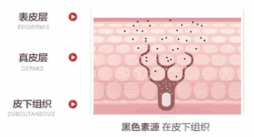 淡化痘印和斑点比较好的产品,美白淡化痘印产品真实测评