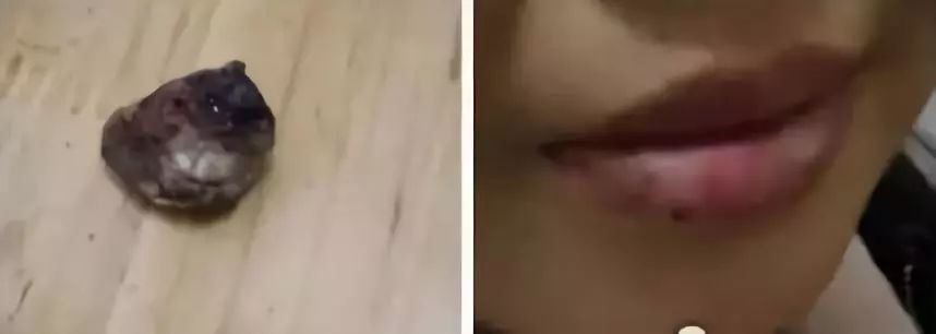 嘴唇干了起皮了可以咬掉吗,嘴唇干起皮咬掉以后会留疤吗