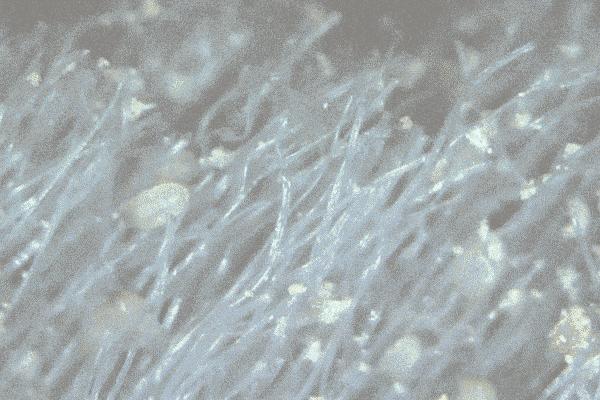 不用洗床单晒被子怎么除螨虫,螨虫去除妙招不用花露水