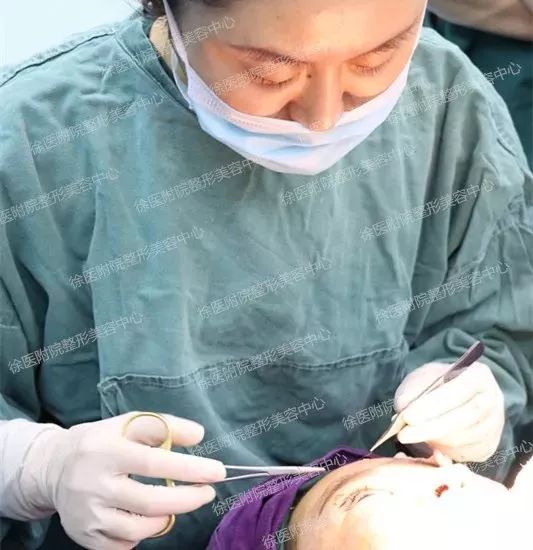 双眼皮失败又不想修复怎么办,双眼皮失败修复方法如下