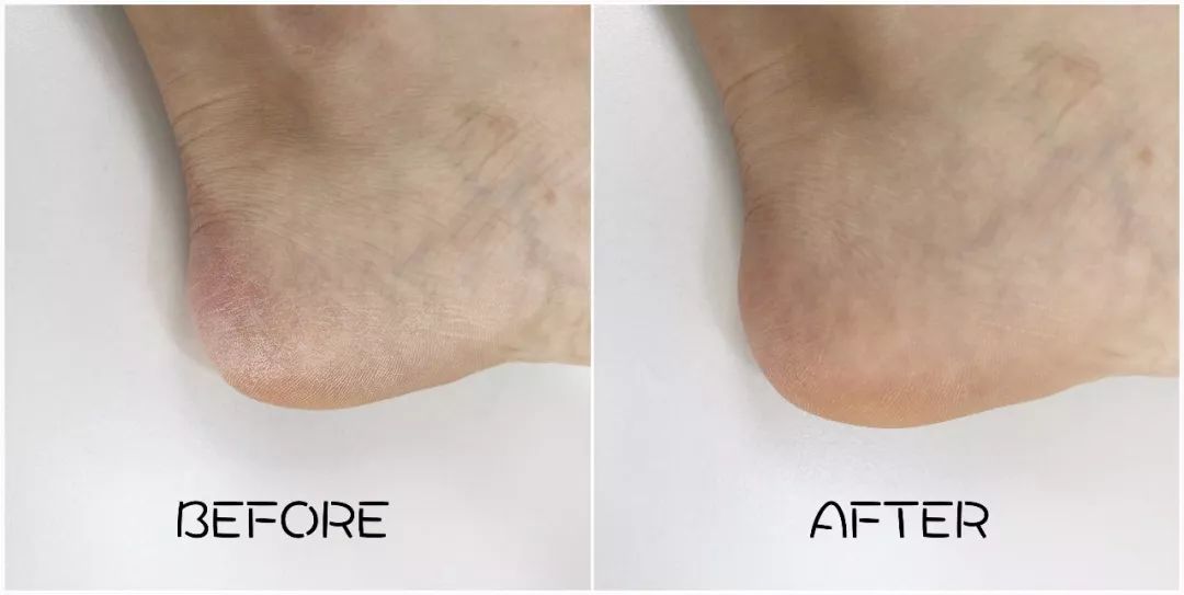 团购预告｜嫩出水、白成雪、滑溜溜的肌肤，靠这款身体乳就够了