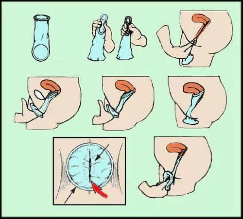 花式套套小盘点