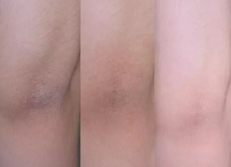 精致从头到脚,细节展现气质,一块嫩红皂让你6周变粉嫩少女!