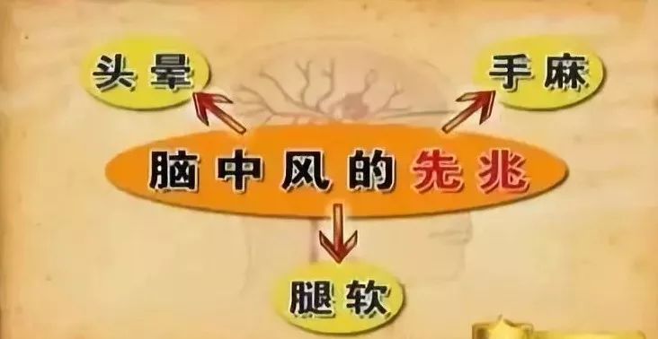 康复锻炼手麻是怎么回事,手麻的治疗思路这5个点要记住