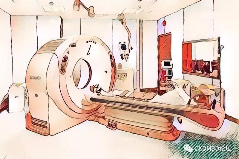 甲状旁腺射频消融术的全过程,后悔做甲状旁腺射频消融