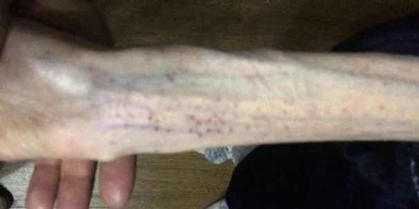 高三女生3个月只吃黄瓜！出大事了！妈妈哭死：怎么劝都不听……