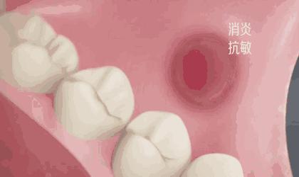 牙黄口臭三分钟见效,牙黄口臭去烟渍