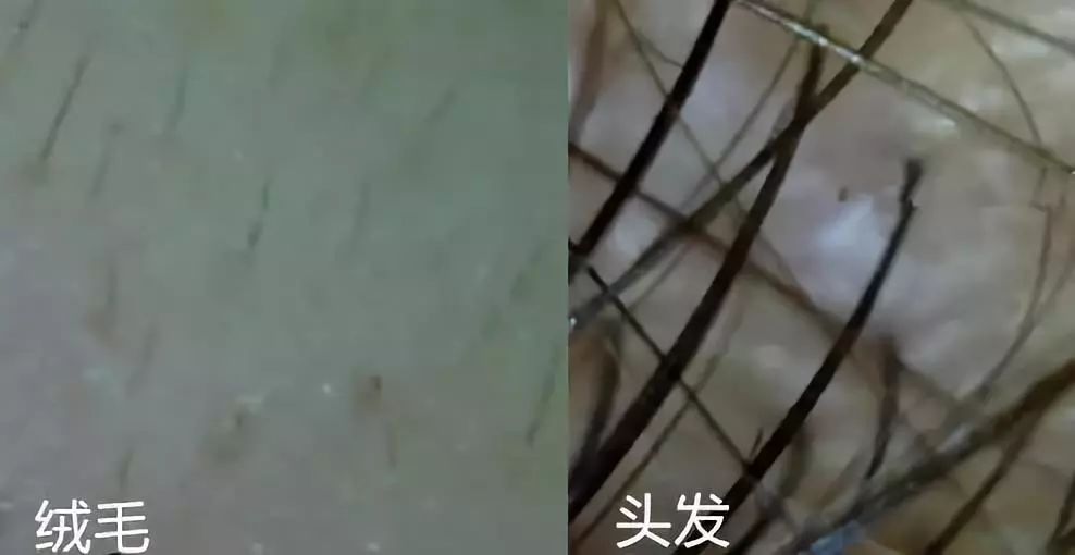 额前新长出的碎发怎么办,额前碎发长出来了