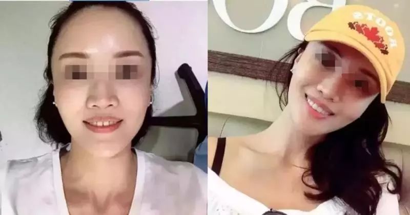 再等几天，江西人矫正牙齿、种植牙这些项目全免费，太爽了！