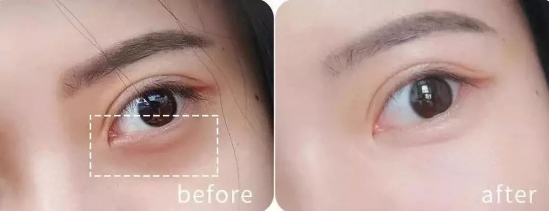 韩国牌子眼霜抗老去皱保湿,平价好用的韩国化妆品牌