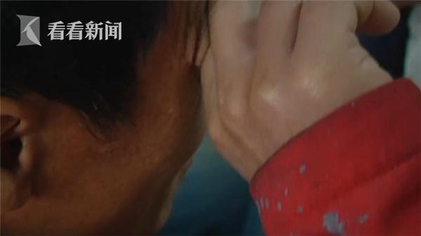 老人黑眼球边缘有白色影响视力,老人眼睛黑眼球变浑浊