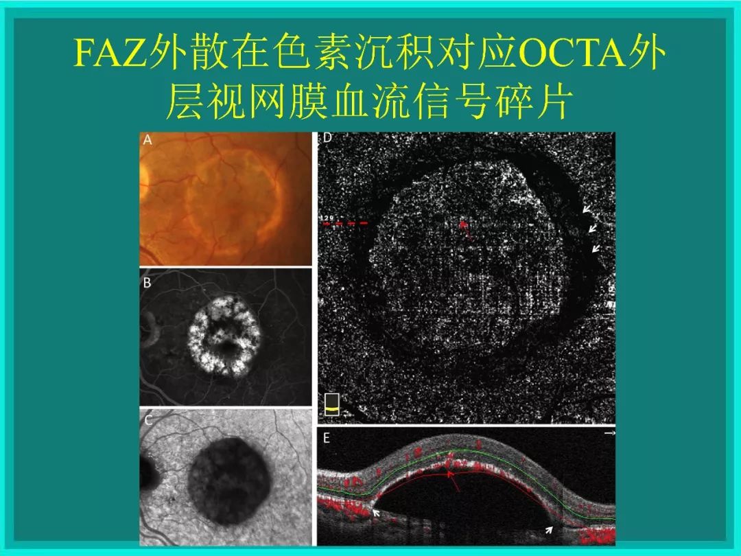 明者远见于未萌原文,明者远见于未萌解释
