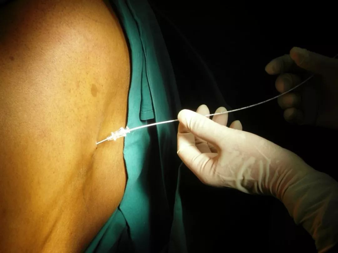 有关疼痛的科普视频,关于疼痛的科普题目