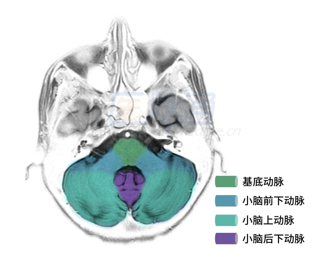 超详细脑供血系统解剖秒懂收藏级,脑动脉供血区域示意图图片