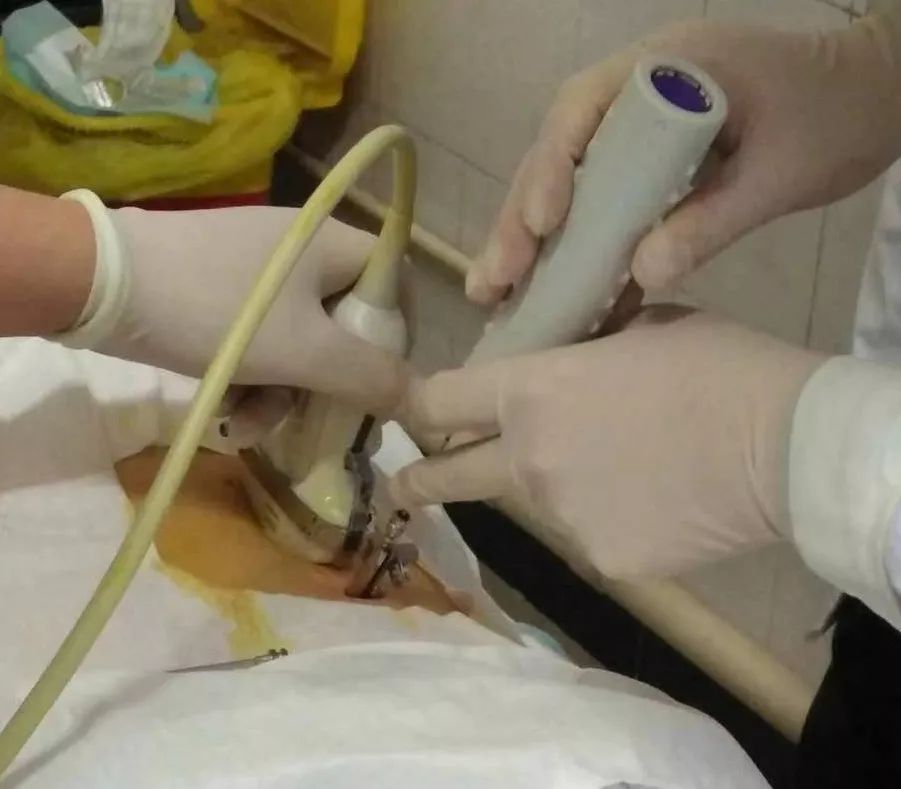 透析患者“生命线”的守护人,透析肾友保护好我们的生命线