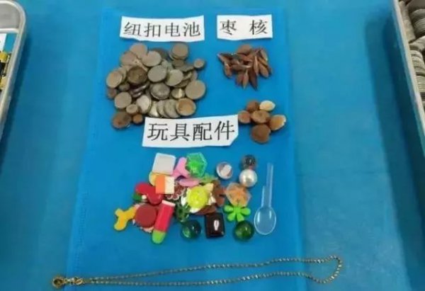 妈妈给孩子换尿布发现嘴里一个洞,儿童换尿布时吞耳环