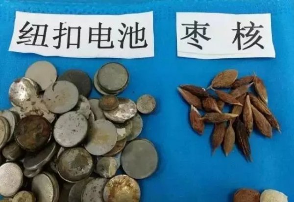 妈妈给孩子换尿布发现嘴里一个洞,儿童换尿布时吞耳环