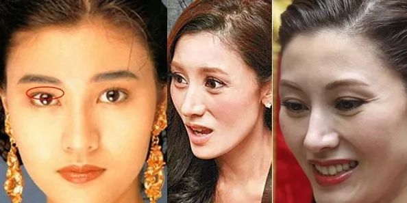 胶原蛋白怎么补吃什么,胶原蛋白怎么补才能吸收得好