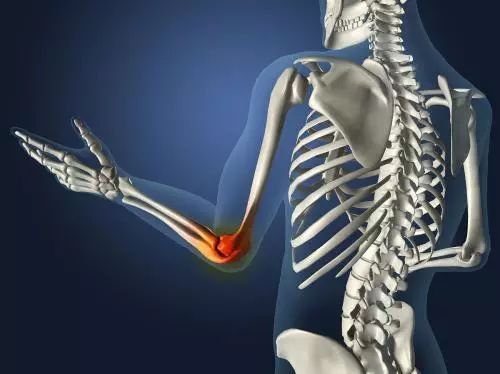 风湿系统性红斑狼疮可治愈吗,强直风湿痛风