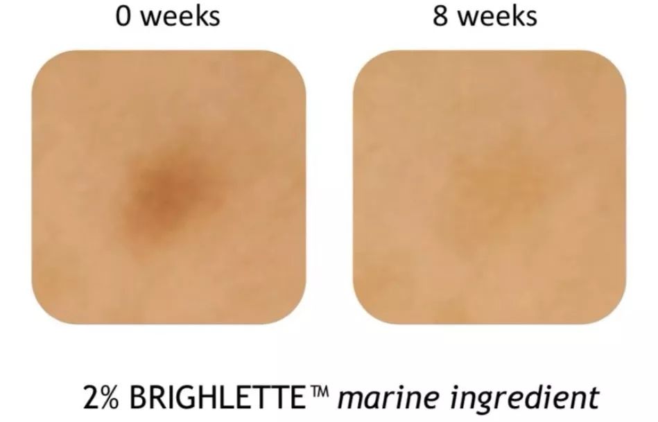 美白针可以10天打一次吗,可以美白的针