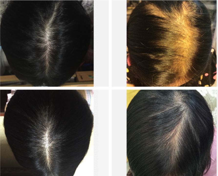 想为颜值偷偷加分？但只有10%的人会机智地修饰这里诶！