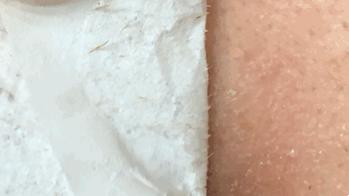 怎么把脸上的黑头清掉,去黑头推荐全脸