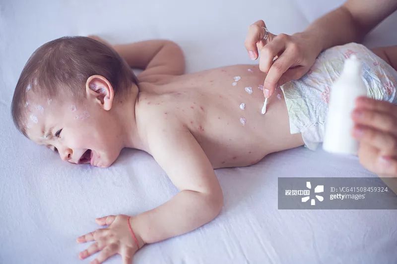 去毒火的中成药,儿童去火药