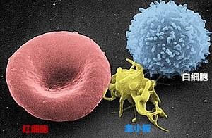 白细胞高是细菌感染用什么药,血常规白细胞高细菌感染吃抗生素