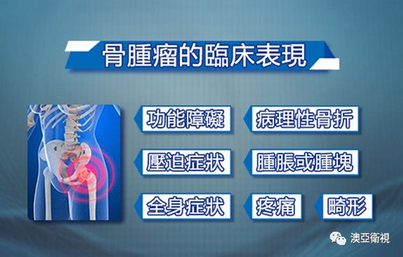 中国医学科学院肿瘤医院于胜吉,于胜吉医生怎么样