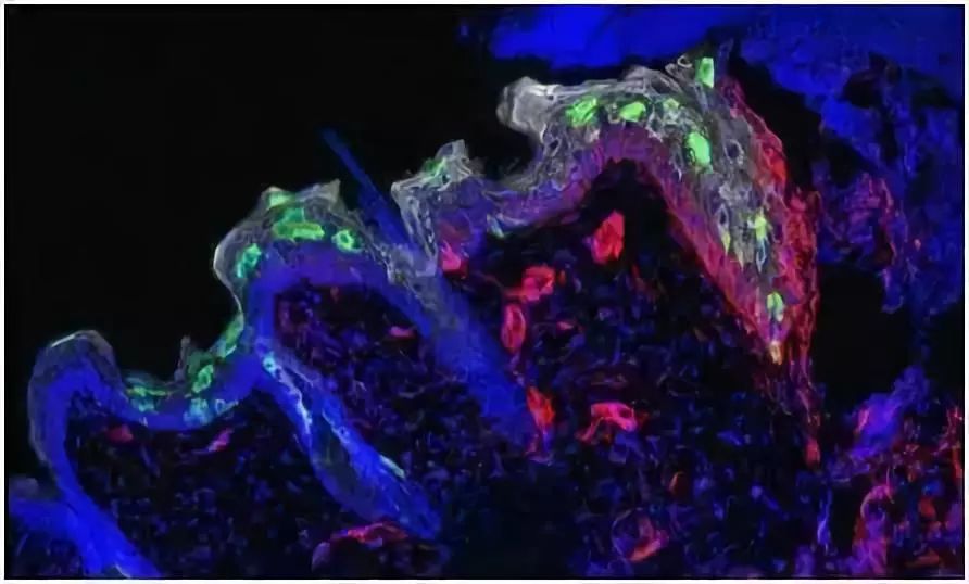 小茂肌诊室到底有多强,小茂肌诊室皮肤状态