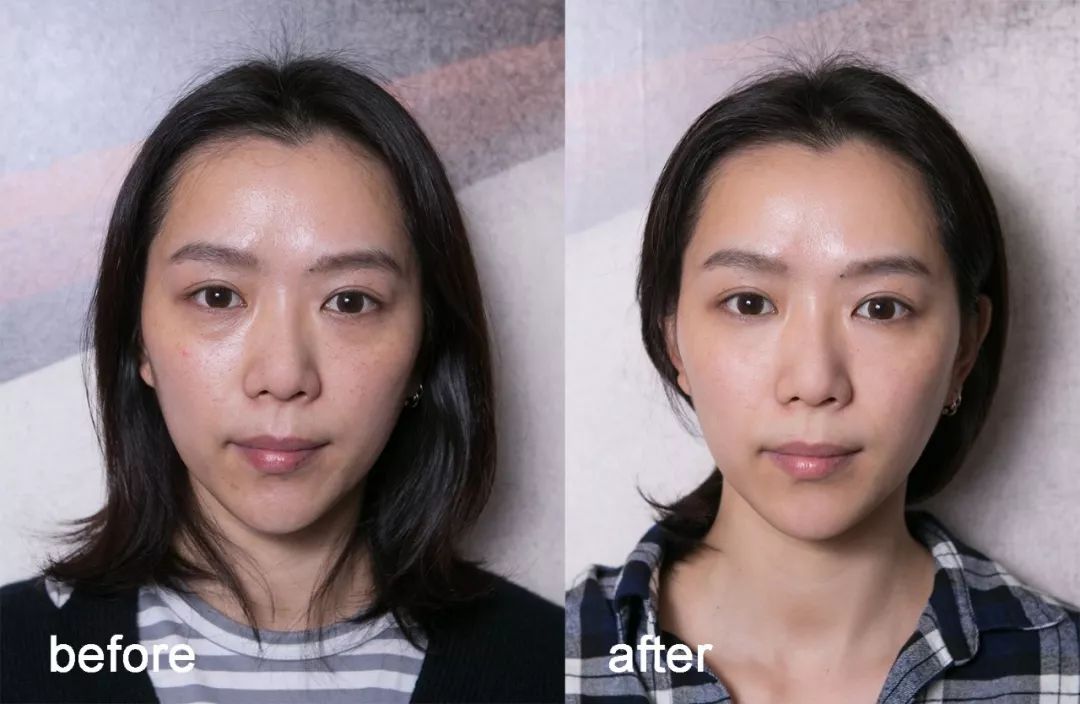 小茂肌诊室到底有多强,小茂肌诊室皮肤状态