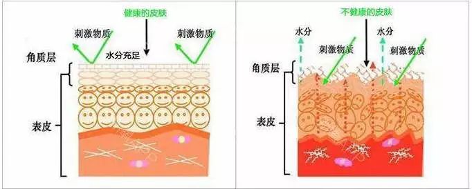 痘印红血丝修复护肤品平价,痘印泛红团购