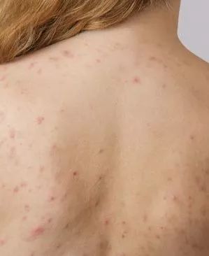 姑娘我看你印堂发黑下一句,姑娘我看你印堂发黑下一句是什么