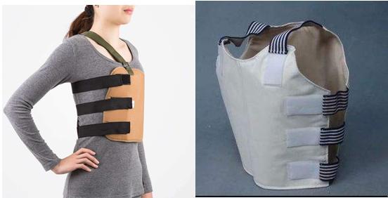 能代替石膏的支具,治疗骨折用石膏的优点