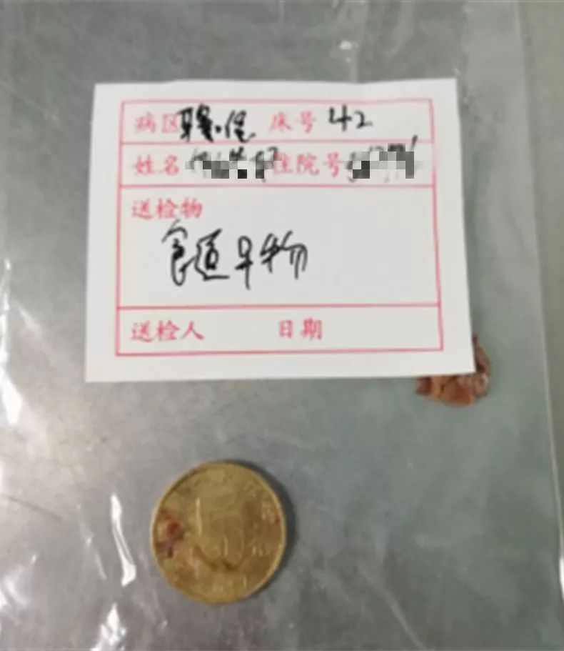 1岁娃连吐四五天，最后竟要全麻手术！只因爸爸忽视了一句话……