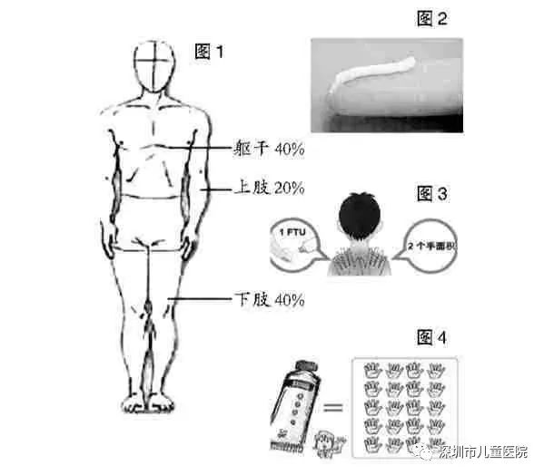 湿疹反复发作是什么原因,孩子湿疹为什么会反复发作