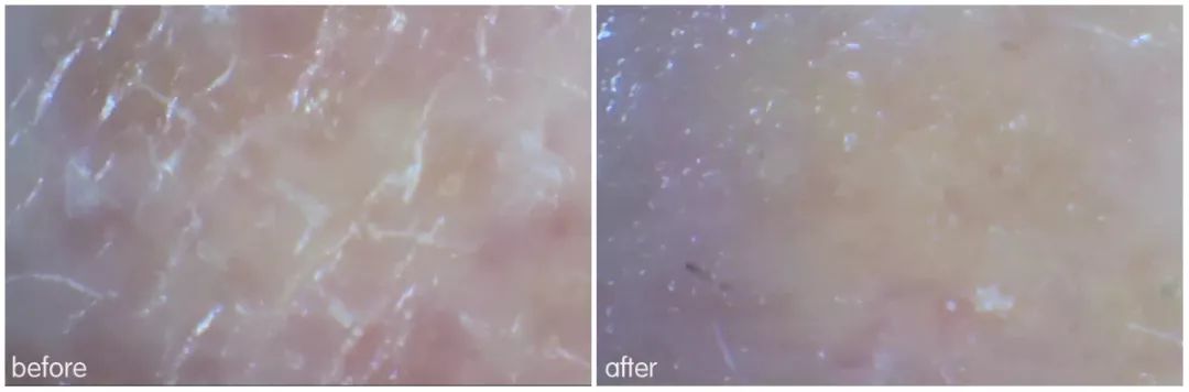 灏忚寕鑲岃瘖瀹ゅ埌搴曟湁澶氬己,灏忚寕鑲岃瘖瀹よˉ姘村悧