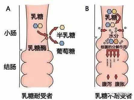 宝宝乳糖酶缺乏是什么原因导致的,缺乏乳糖对身体有什么影响