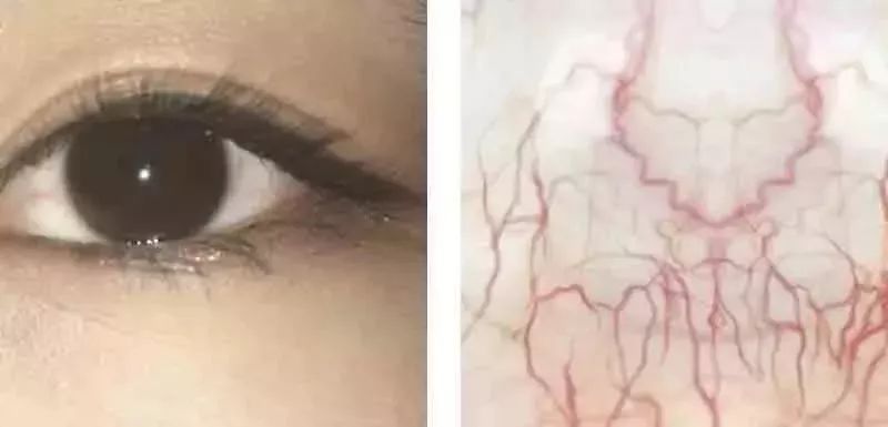 【海淘】用眼过度，酸胀疼痛+*血丝红**？5秒来一场冰泉SPA！爽爆了