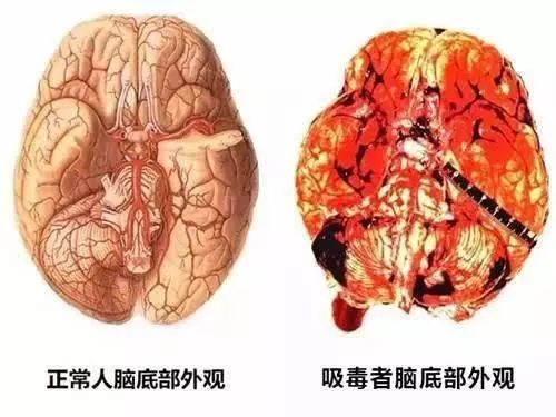 毒冰为什么叫毒冰,毒冰是什么