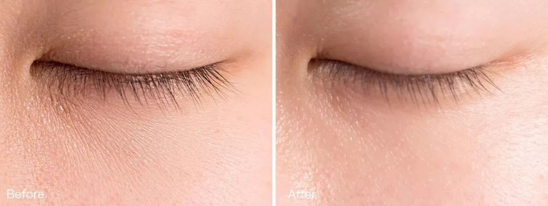 25岁必须用眼霜了吗,25岁之后适合用什么眼霜