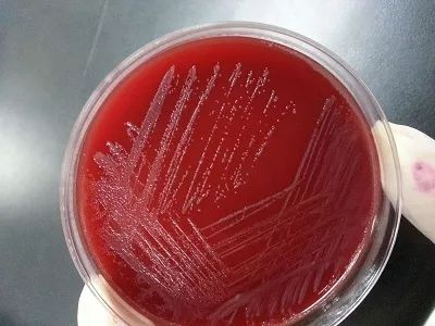 阴道炎老是复发，别再怪老公了！妇产科医生说出大实话！