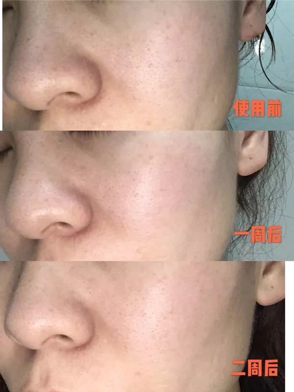 盲测14天揭密|年轻肌特训营收关，那瓶好评如潮的精华水究竟是谁？